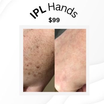 A Smoother You - Skin Care Near Me - Dracut, Massachusetts