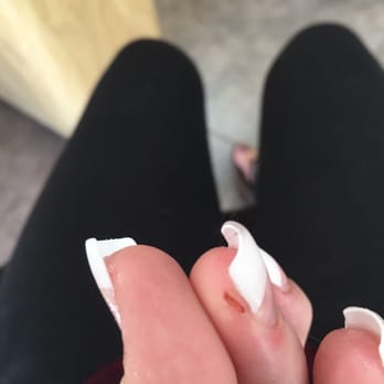 Happi Nails - This is the cut after I washed it out with water - Nail Salons Near Me - Las Vegas, Nevada Happi Nails - This is the cut after I washed it out with water - Nail Salons Near Me - Las Vegas, Nevada