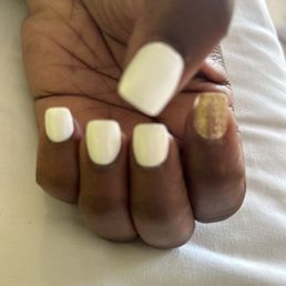 My right hand I am experiencing the same thing with the middle fingers and thumb and they are crooked. My right hand I am experiencing the same thing with the middle fingers and thumb and they are crooked.