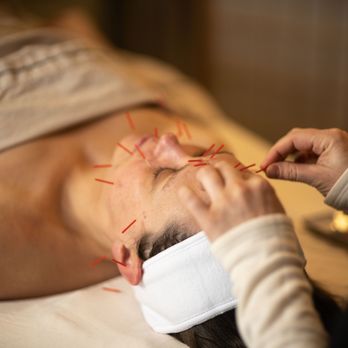 Luminous Well-Being - Cosmetic Acupuncture A holistic alternative to botox, this method awakens your skin's natural vitality, offering a youthful and radiant glow - Acupuncture Near Me - Ashland, Oregon Luminous Well-Being - Cosmetic Acupuncture A holistic alternative to botox, this method awakens your skin's natural vitality, offering a youthful and radiant glow - Acupuncture Near Me - Ashland, Oregon