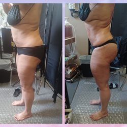 Total Image Master Body Sculpting - Pay for your Results