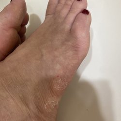 Image Nails - Terrible pedicure