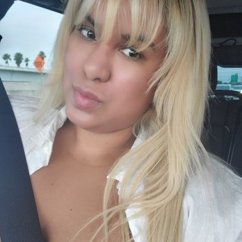 VIP Aesthetic Center - Day After my Vampire Facial with the beautiful and amazing Maria. Still healing. - Medical Spas Near Me - Hallandale Beach, Florida