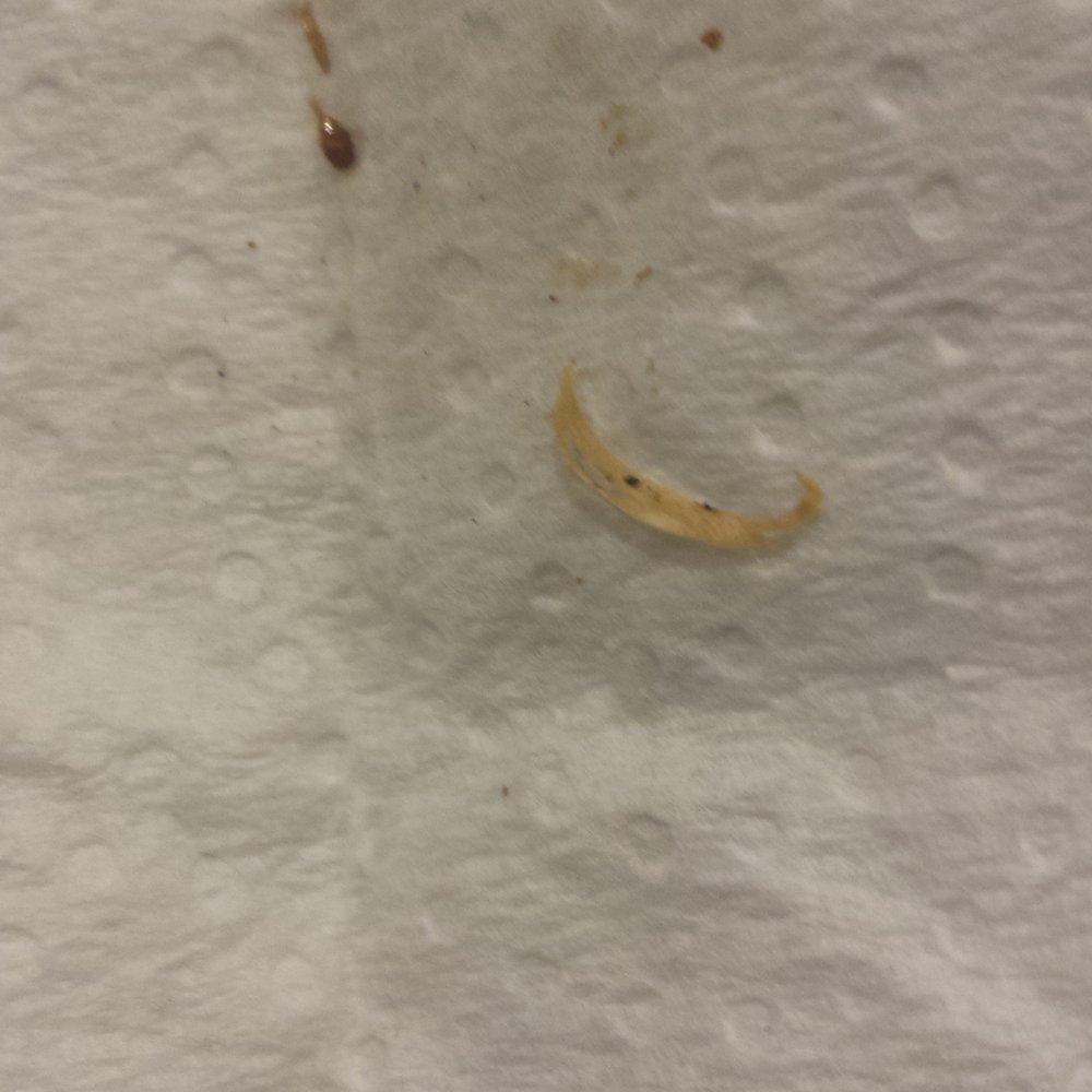 Nando's Peri-Peri - This was the surprise my daughter got with her dinner tonight, its a finger nail. I've have never been so angry. - Chicken Shop Near Me - Surrey, British Columbia