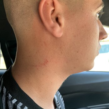 Faded Barbershop - Scrape I have on my neck from the barber...... - Barbers Near Me - San Jose, California