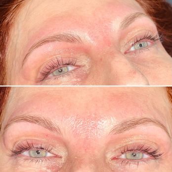 Charm City Skin - Skin Care Near Me - Baltimore, Maryland