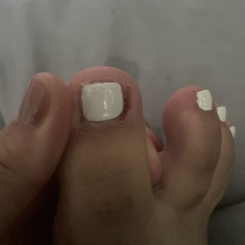 Nail Genie - Bloody toenail - Nail Salons Near Me - Union City, California Nail Genie - Bloody toenail - Nail Salons Near Me - Union City, California