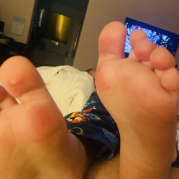 My grandson feet 1 day later .