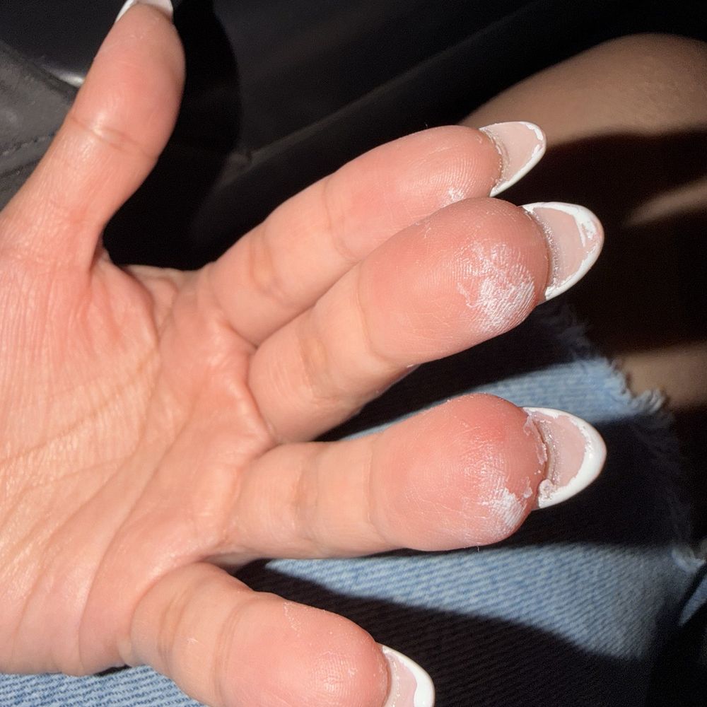 Acrylic residue and white nail polish all over nails that did not come off after scrubbing
