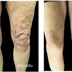 Gary E Russolillo, MD - Before & After