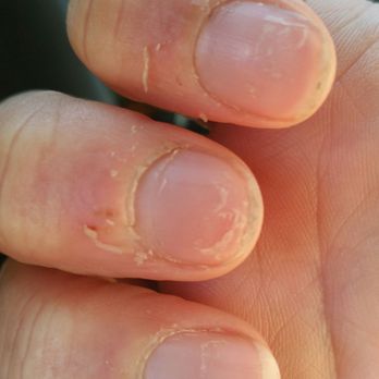 Tranquility Nails & Spa - Cuticles on every finger shredded - Skin Care Near Me - Bellevue, Washington