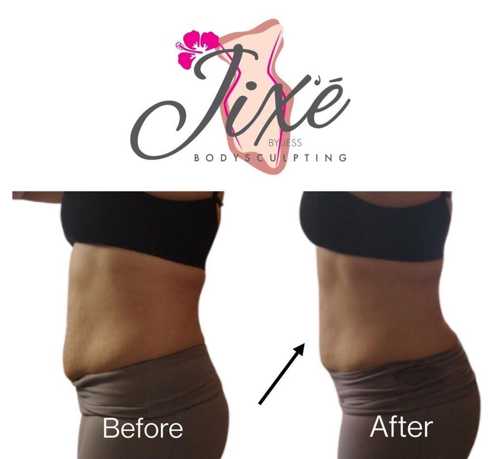 Jix'e Bodysculpting Logo