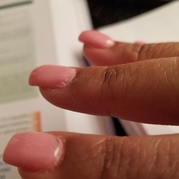 Modo Nail Bar - Crusty, rushed cuticles - A close-up of three fingers with pink nail polish, showing dry, cracked skin and some peeling on the fingers. - Skin Care Near Me - Laurel, Maryland