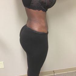 Snatched Body Health Spa - After treatment