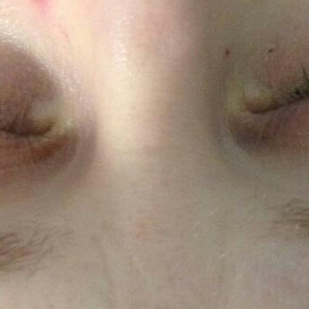 Xtina's Lash Xtensions - After the eyelash extensions were all removed - Eyelash Service Near Me - Palatine, Illinois Xtina's Lash Xtensions - After the eyelash extensions were all removed - Eyelash Service Near Me - Palatine, Illinois