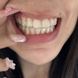 Peninsula Orthodontic Group - After