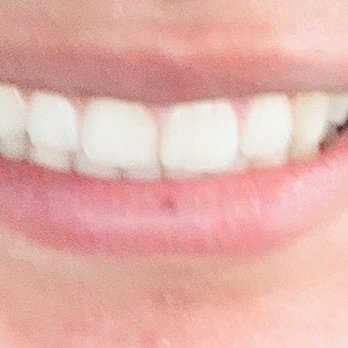 MacGinnis Orthodontics - After treatment - Orthodontists Near Me - Fullerton, California MacGinnis Orthodontics - After treatment - Orthodontists Near Me - Fullerton, California