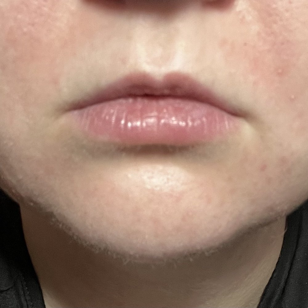 before before