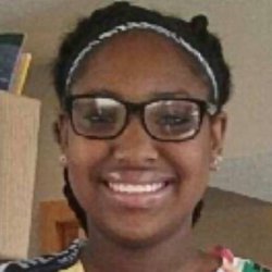 Bussick Orthodontics - Jaida say braces taken off
