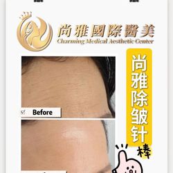 Charming Medical Aesthetic Center - Botox injection
