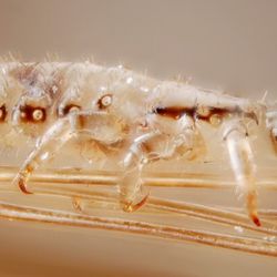 Baby Angel Hair Lice Removal Service - Lice