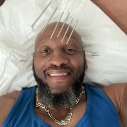 Classical Acupuncture Healing - Hitting the spot every time.  Pressure points tapped into addressing what is giving you grief.  Yes it will help you to smile again.