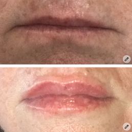 Petite lip. Petite lip.
