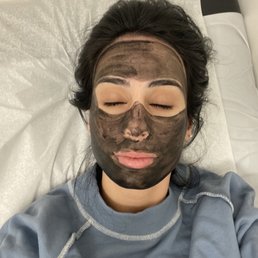 The carbon laser facial treatment
