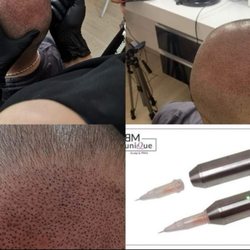 Andrea Höhler - Scalp Micropigmentierung