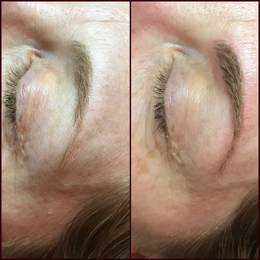 Skin chic med spa picture