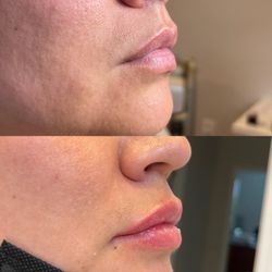 Prolase Medispa