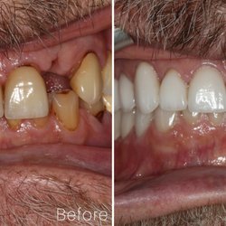 Maplewood Laser Dental Clinic