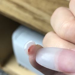 Red Nails - This is the deep cut she did while rushing trimming my nails
