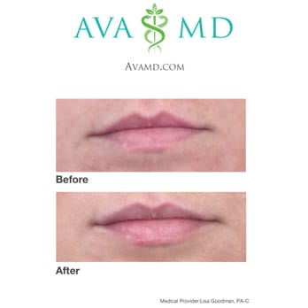 Ava MD - Dermatologists Near Me - Santa Monica, California