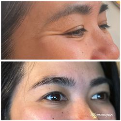Lily Wong - Before after crows feet