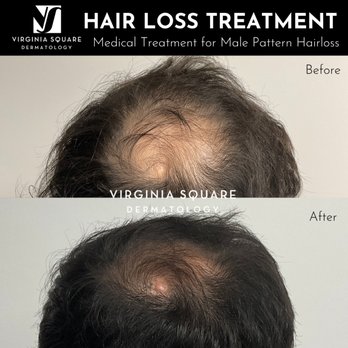 Virginia Square Dermatology - Dermatologists Near Me - Arlington, Virginia Virginia Square Dermatology - Dermatologists Near Me - Arlington, Virginia