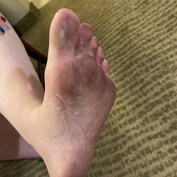 Bahia Resort Hotel - Carpet turning feet black after shower - Day 1 - San Diego, CA