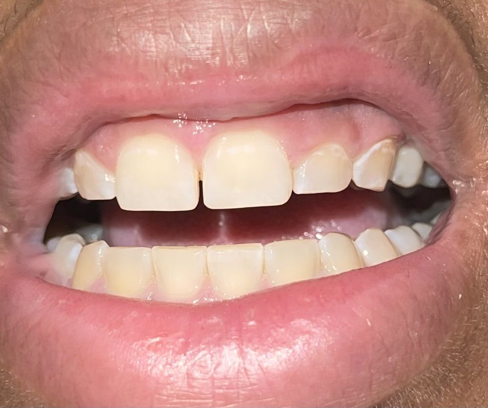 PROSMILES DENTAL Updated September 2024 13 Photos & 13 Reviews