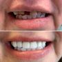Orillia Smile Center