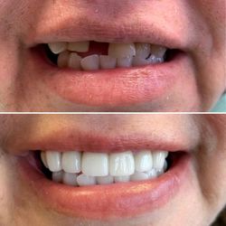 Orillia Smile Center