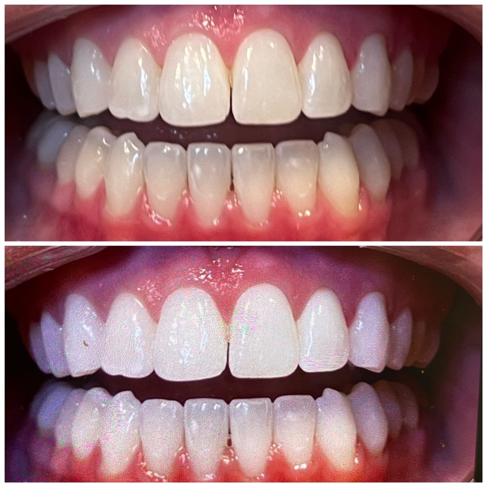 before and after before and after