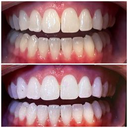 before and after