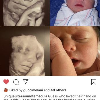 Unique Ultrasound - Diagnostic Imaging Near Me - Temecula, California Unique Ultrasound - Diagnostic Imaging Near Me - Temecula, California