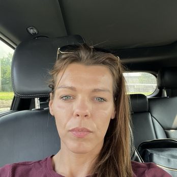 Refresh MedSpa - Immediately after the procedure. - Medical Spas Near Me - Branchburg, New Jersey Refresh MedSpa - Immediately after the procedure. - Medical Spas Near Me - Branchburg, New Jersey