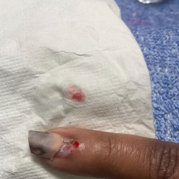Lux Nails - Drilled into my nail bed and removed my cuticle - Nail Salons Near Me - Chester, Virginia