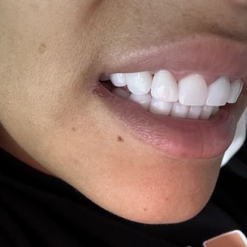 My Smile Center - General Dentistry Near Me - Miami, Florida My Smile Center - General Dentistry Near Me - Miami, Florida