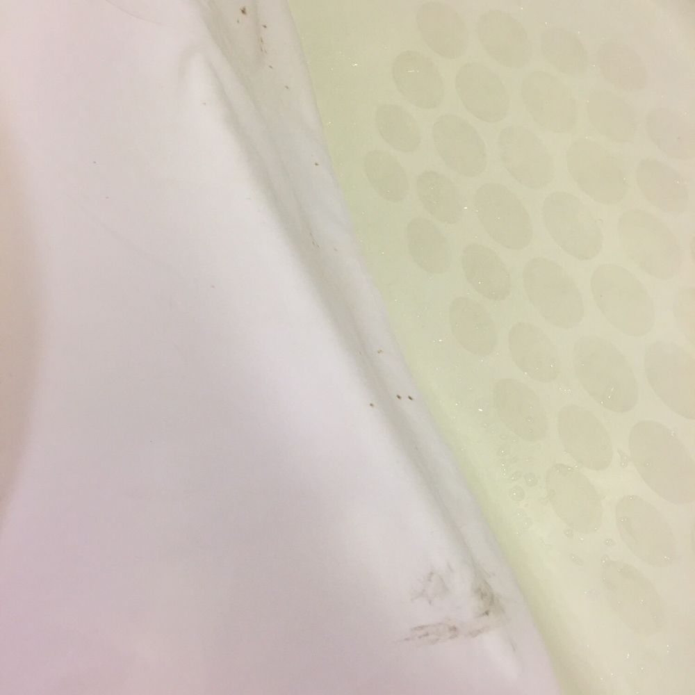 Wyndham Springfield City Centre - Mold on shower curtain - Hotels Near Me - Springfield, Illinois Wyndham Springfield City Centre - Mold on shower curtain - Hotels Near Me - Springfield, Illinois