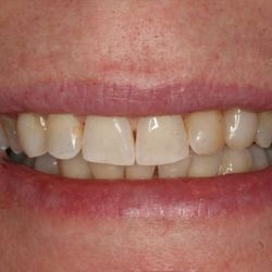 The Dental Design Center - Cosmetic, Implant & General Dentistry