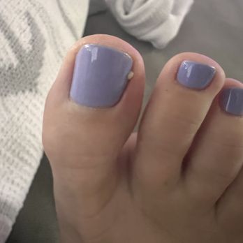 Chloe Nails - Infected big toe ;( - Nail Salons Near Me - Lomita, California Chloe Nails - Infected big toe ;( - Nail Salons Near Me - Lomita, California