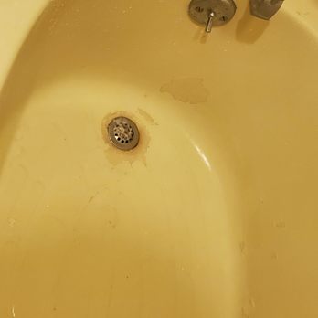 Diamondhead Inn and Suites - Bath tub peeling apart - Hotels Near Me - Bay St. Louis, Mississippi Diamondhead Inn and Suites - Bath tub peeling apart - Hotels Near Me - Bay St. Louis, Mississippi